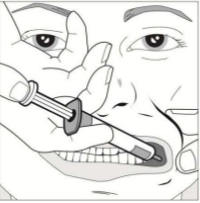 3. BUCCOLAM Lösung zur Anwendung in der Mundhöhle