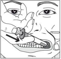 4. BUCCOLAM Lösung zur Anwendung in der Mundhöhle